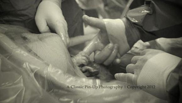 Increíble: Bebé agarra dedo de médico antes de salir del vientre de su madre