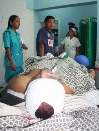 Huachimán recibe disparo en la cara