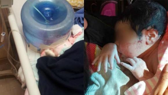 Improvisan máscara de oxígeno utilizando un bidón de agua para recién nacido 