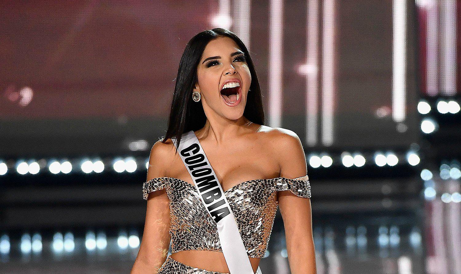 La respuesta de Miss Colombia a las burlas por su sonrisa (FOTO)