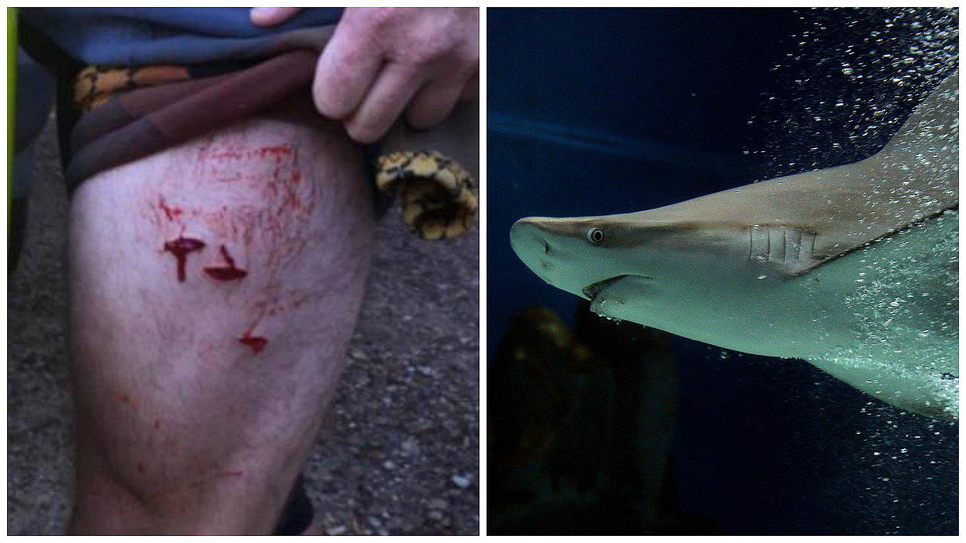 Tiburón ataca a surfista en una playa y esto fue lo que salvó su vida 