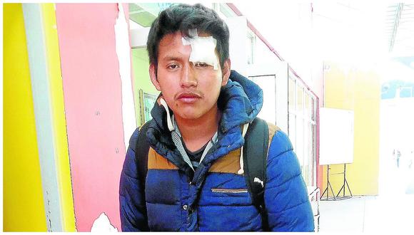​Estudiante culpa a serenos de golpearlo durante la serenata a Huancayo