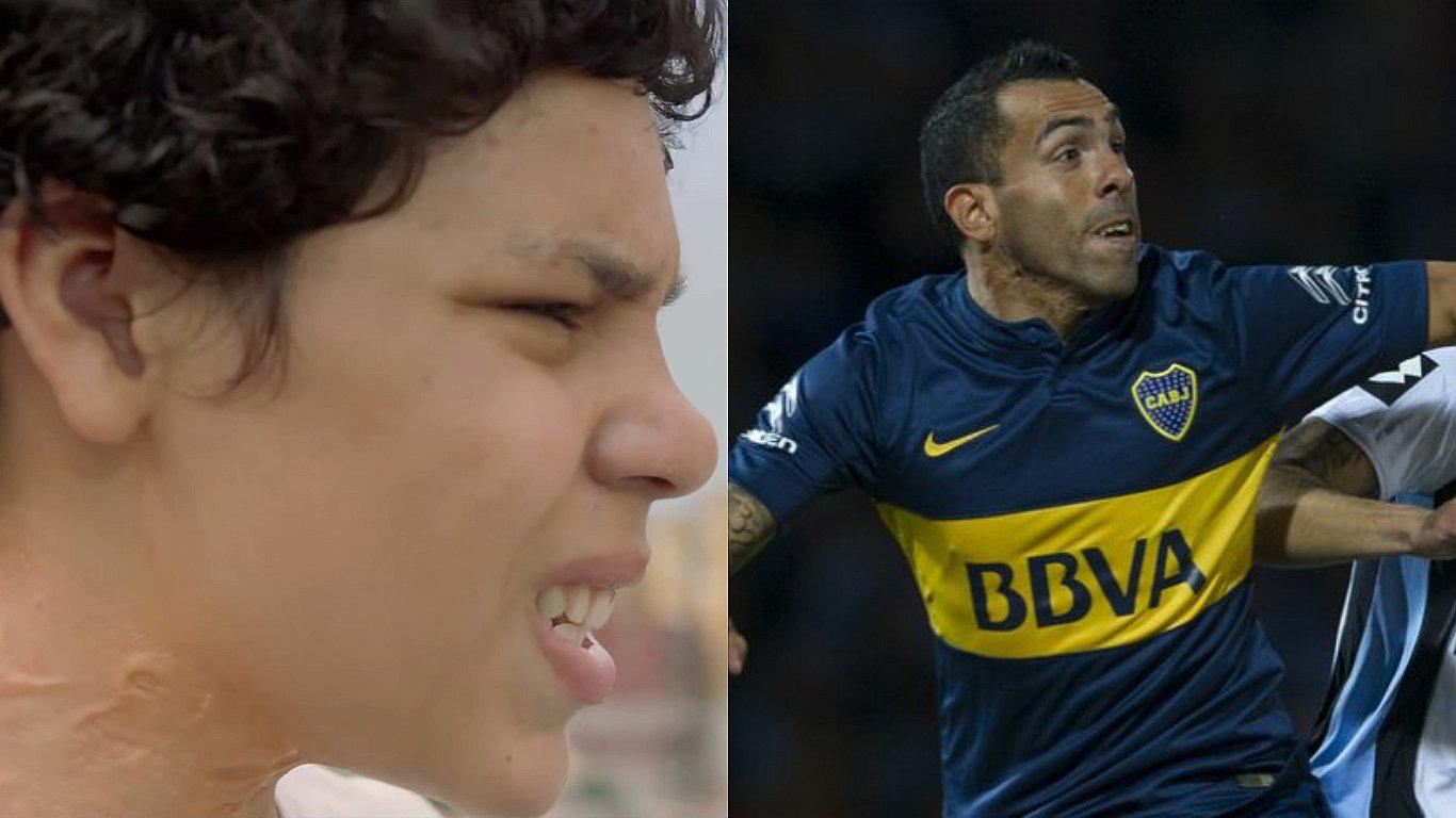 Carlos Tévez: Serie abordará el origen de la cicatriz del 'apache' (VIDEO)