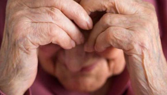 Delincuentes desfiguraron el rostro de una abuelita de 84 años (FOTOS)
