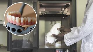 Niño recibe el primer trasplante de mandíbula creada con una impresora 3D (FOTO)