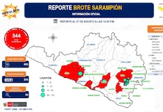 Sarampión en Arequipa: Camaná registra 180 de los 344 casos confirmados en la región