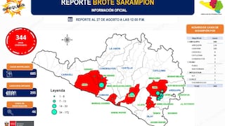 Sarampión en Arequipa: Camaná registra 180 de los 344 casos confirmados en la región