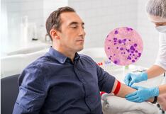 Mieloma múltiple, el segundo cáncer más común en la sangre