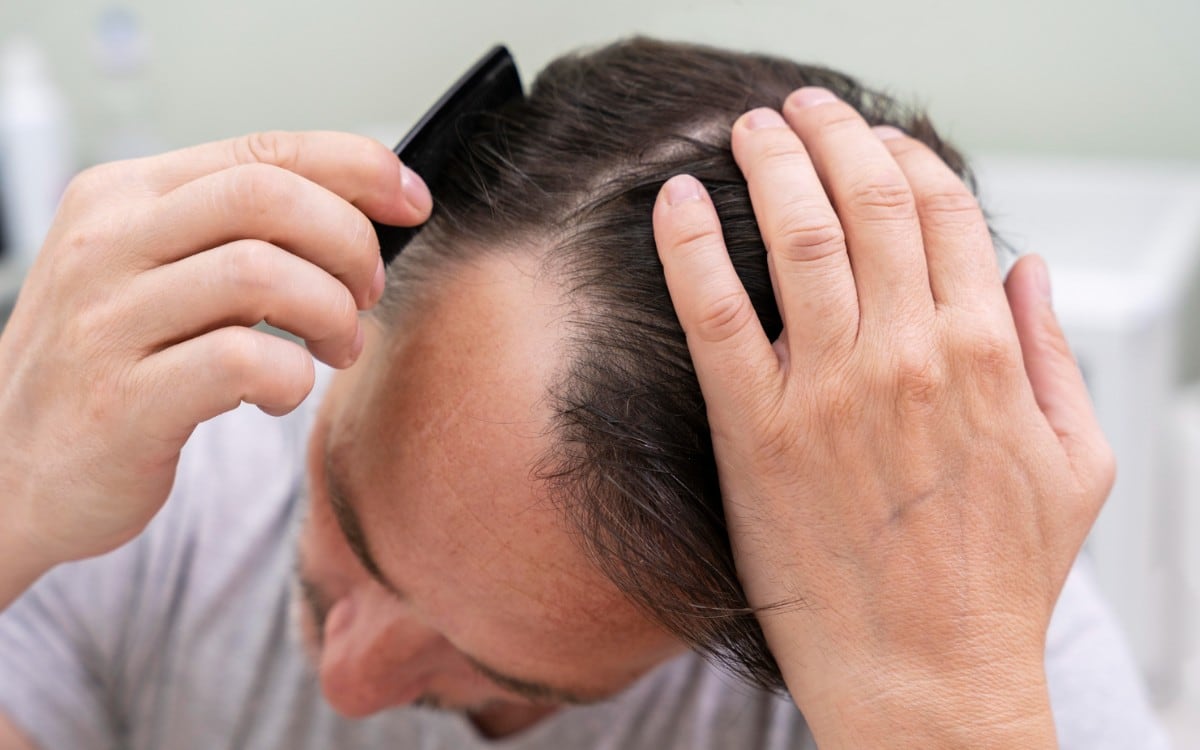 Caída del cabello: cuánto es normal y qué tratamientos pueden ayudar a frenarla