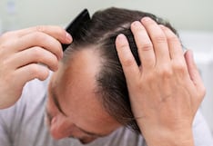 Caída del cabello: cuánto es normal y qué tratamientos pueden ayudar a frenarla