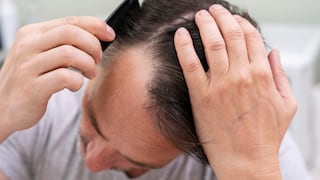 Caída del cabello: cuánto es normal y qué tratamientos pueden ayudar a frenarla