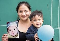 Cirugías gratuitas para recuperar sonrisas de niños y adultos con labio fisurado