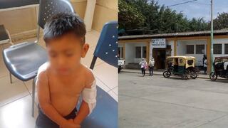 Lambayeque: niño sufre quemaduras graves tras caer en olla con agua hirviendo