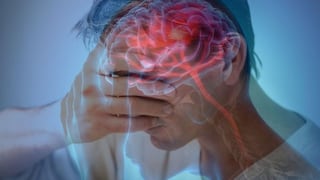 Día Mundial del Accidente Cerebrovascular: Cinco mitos que debes conocer