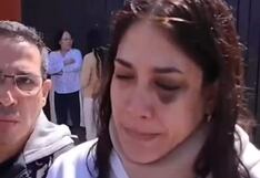 Hermana de Evelyn Vela denuncia que fue agredida por su esposo cantante: “Su cabeza está llena de bolas de golpes”