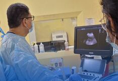 Hospital de EsSalud Ica realiza nefrostomía percutánea guiada a paciente con neoplasia