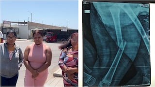 Pisco: menor requiere una referencia a un hospital especializado en Lima para ser operado