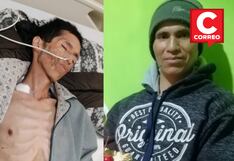 Huancayo: Paciente requiere dilatador de esófago para alimentarse