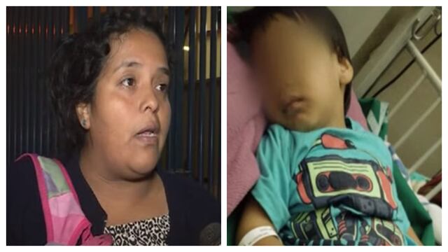 Mujer denunció que su hijo no recibió atención al sufrir accidente en Estación Caja de Agua (VIDEO)