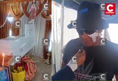 Arquero sobrevivió a impacto de rayo en Huancayo: “Estoy sorprendido de estar vivo”