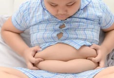 OMS desaconseja medicamentos y cirugía para tratar la obesidad en menores de 10 años