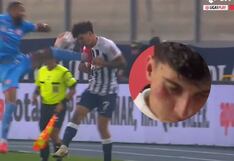 Así quedó la cara de Franco Zanelatto tras la dura falta de Alexi Gómez (VIDEO)