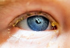 ¿Qué son las legañas y cuándo pueden indicar un problema de salud ocular?