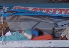 Iquitos: Mujer sufrió graves quemaduras tras ser atacada con fuego por su pareja