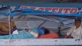 Iquitos: Mujer sufrió graves quemaduras tras ser atacada con fuego por su pareja