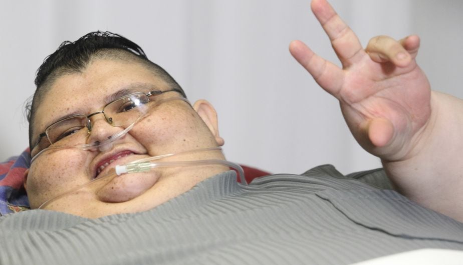 El mexicano murió a los 41 años tras complicaciones de salud, según confirmó el médico que lo trató durante su proceso de reducción de peso. (EFE)