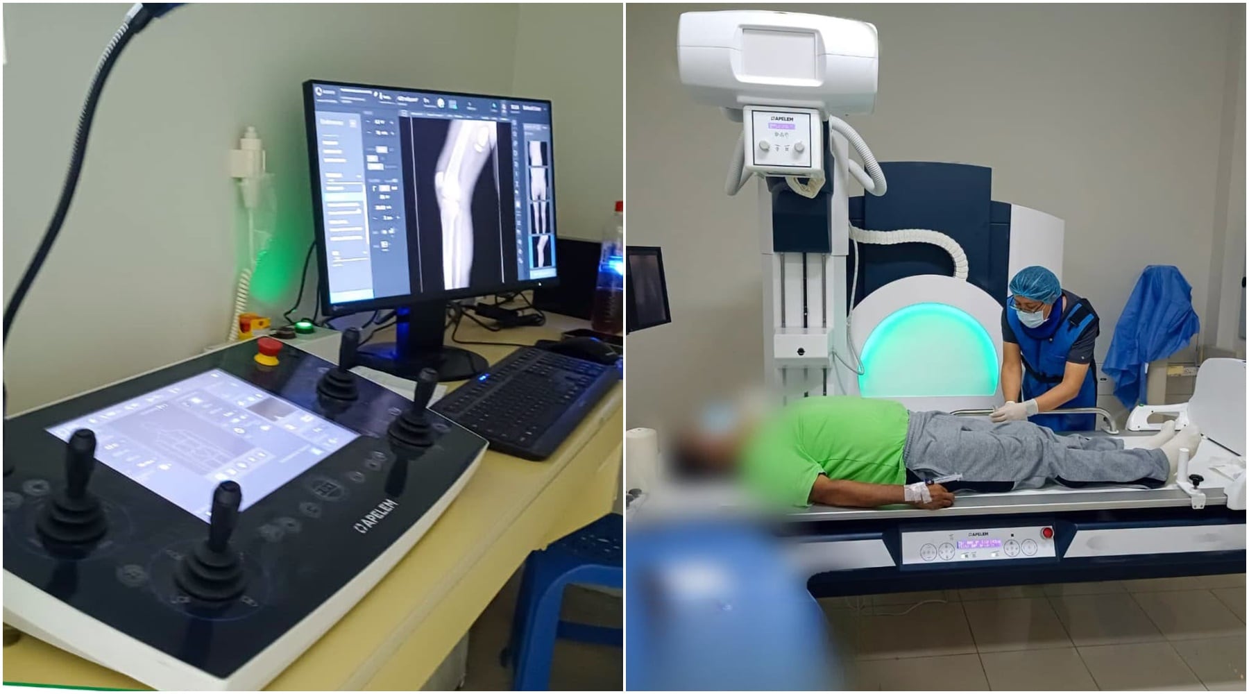 Ica: Hospital Socorro supera las 350 atenciones con nuevo equipo de Rayos X con fluoroscopia