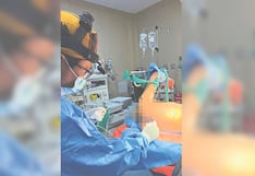 Hospital Honorio Delgado de Arequipa: Reconstruyen mamas a pacientes con cáncer