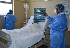 Junín registra más de 700 casos de tuberculosis y refuerzan medidas de control