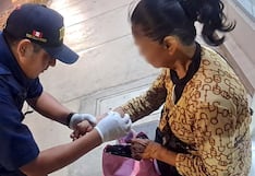 Trujillo: Anciana es atacada por un perro y sufre lesiones en brazos y piernas