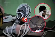 Ventanilla: denuncian albañil por ejercer como dentista y utilizar alicates para atender pacientes