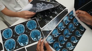 Esclerosis múltiple en Perú: solo 500 de 3000 afectados reciben tratamiento adecuado