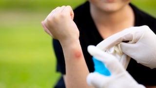 Semana Santa: cómo actuar ante golpe de calor, picaduras y casi ahogamiento