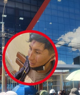 Puno: Violento enfrentamiento entre universitarios deja varios heridos en la Universidad Nacional del Altiplano