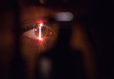 Glaucoma: ocho mitos y verdades sobre el “ladrón silencioso de la visión”