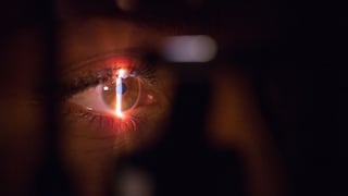 Glaucoma: ocho mitos y verdades sobre el “ladrón silencioso de la visión”