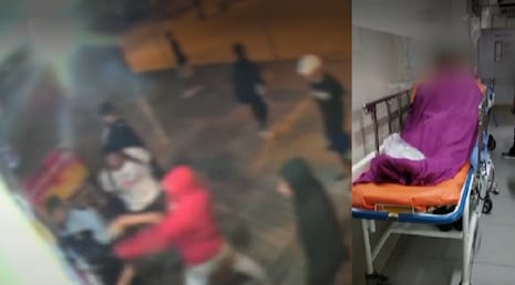 SJL: Escolar fue atacado a golpes y acuchillado a la salida de colegio
