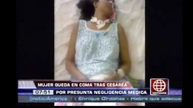 Mujer queda en coma luego de ser sometida a una cesárea