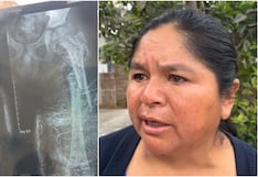 Ica: pide apoyo para operación de su hijo de 6 años con fractura de fémur, tras caerle una puerta de fierro
