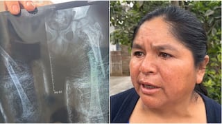 Ica: pide apoyo para operación de su hijo de 6 años con fractura de fémur, tras caerle una puerta de fierro