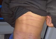 Agreden brutalmente a niño en poblado de Yanacocha, Huánuco