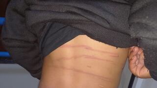 Agreden brutalmente a niño en poblado de Yanacocha, Huánuco