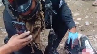 Colombiano es herido de bala tras ser atacado por dos venezolanos en Amarilis