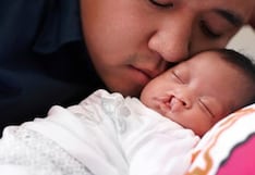 EsSalud realizará cirugías gratuitas a niños con labio leporino en Trujillo