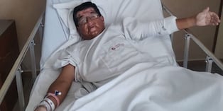 Alfredo Galindo Peralta cayó del tercer al segundo piso de su vivienda cuando realizaba limpieza.