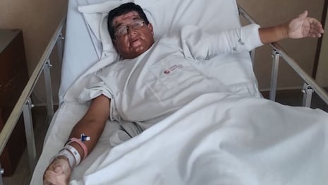 Candidato a diputado sobrevive tras accidente en Trujillo